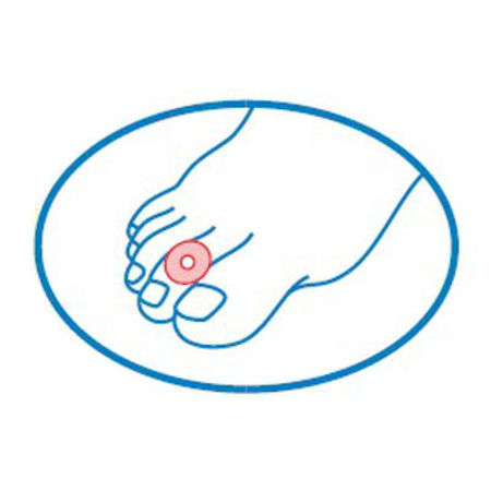 Obrázok pre kategóriu Kroužky na prsty